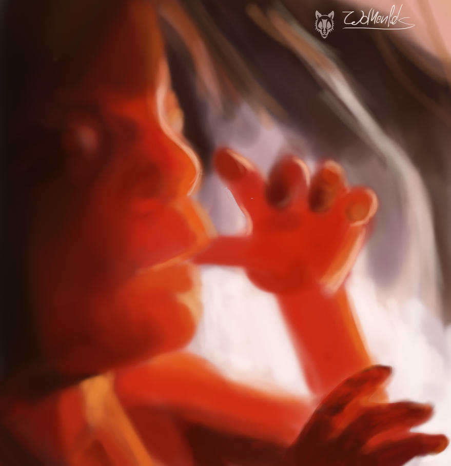 [Image: fetus___spitpaint_by_wolkenfels-d6s5lhy.jpg]
